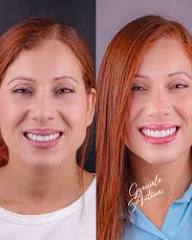 Resultado