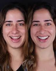 Resultado